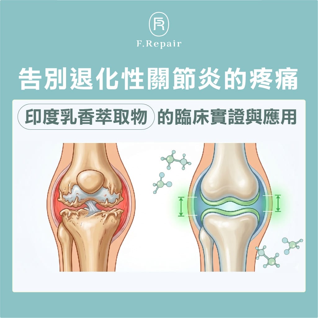 乳香關節炎