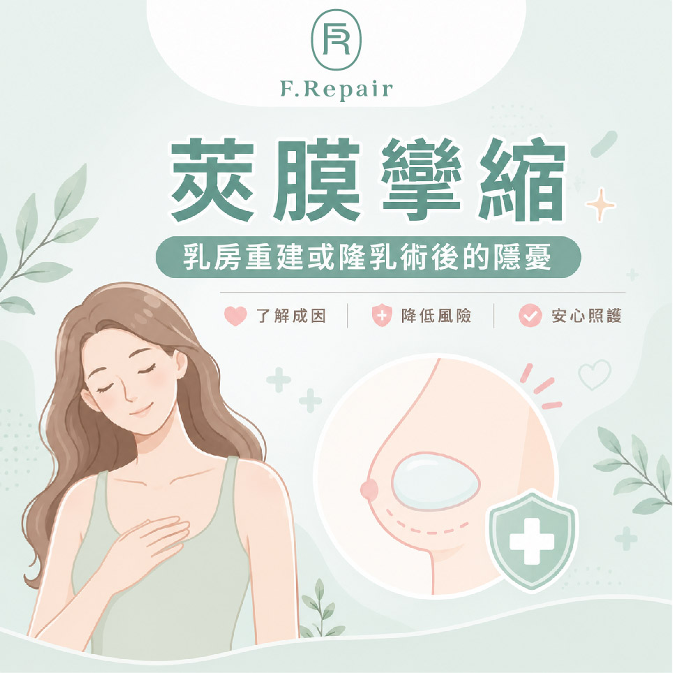 小芙-